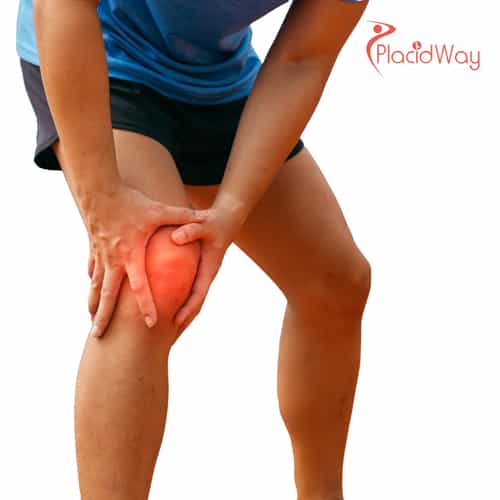 Osteoarthritis Stem Cell Treatment in Malaysia for Joint Regeneration and Pain Reduction